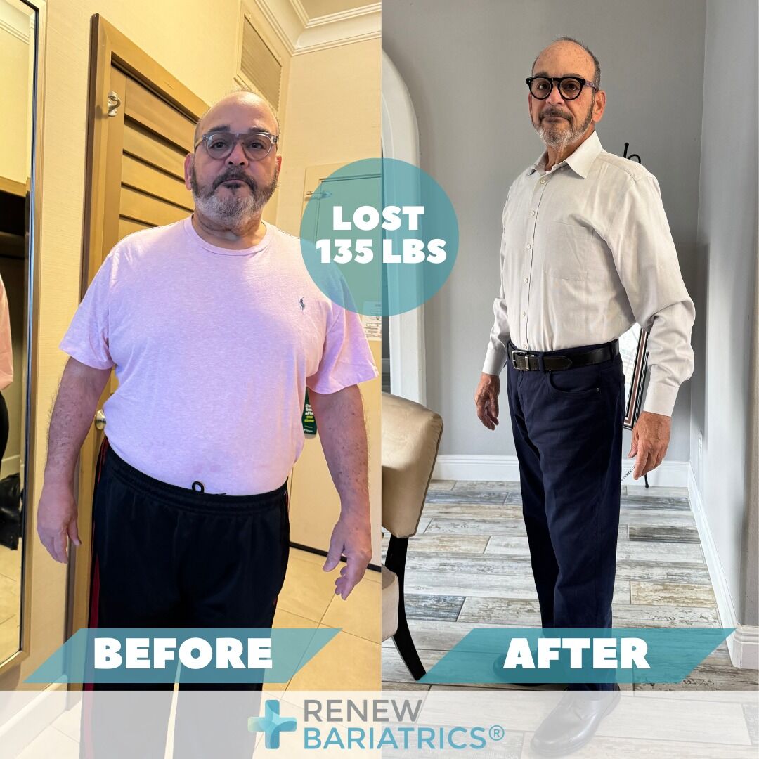 Heriberto H. gastric bypass before-and-after photos, published by Renew Bariatrics