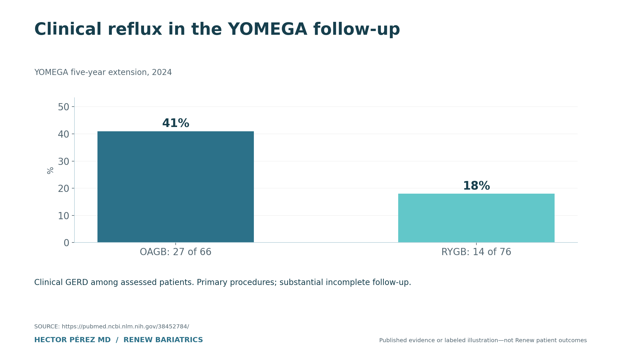 Clinical reflux in the YOMEGA follow-up. OAGB: 27 of 66: 41%; RYGB: 14 of 76: 18%. Clinical GERD among assessed patients. Primary procedures; substantial incomplete follow-up.